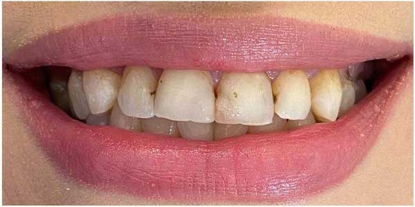 case 1 - قبل