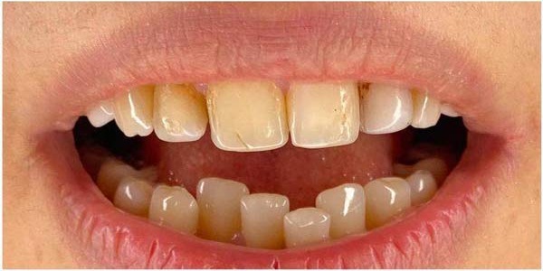 case 4 - قبل